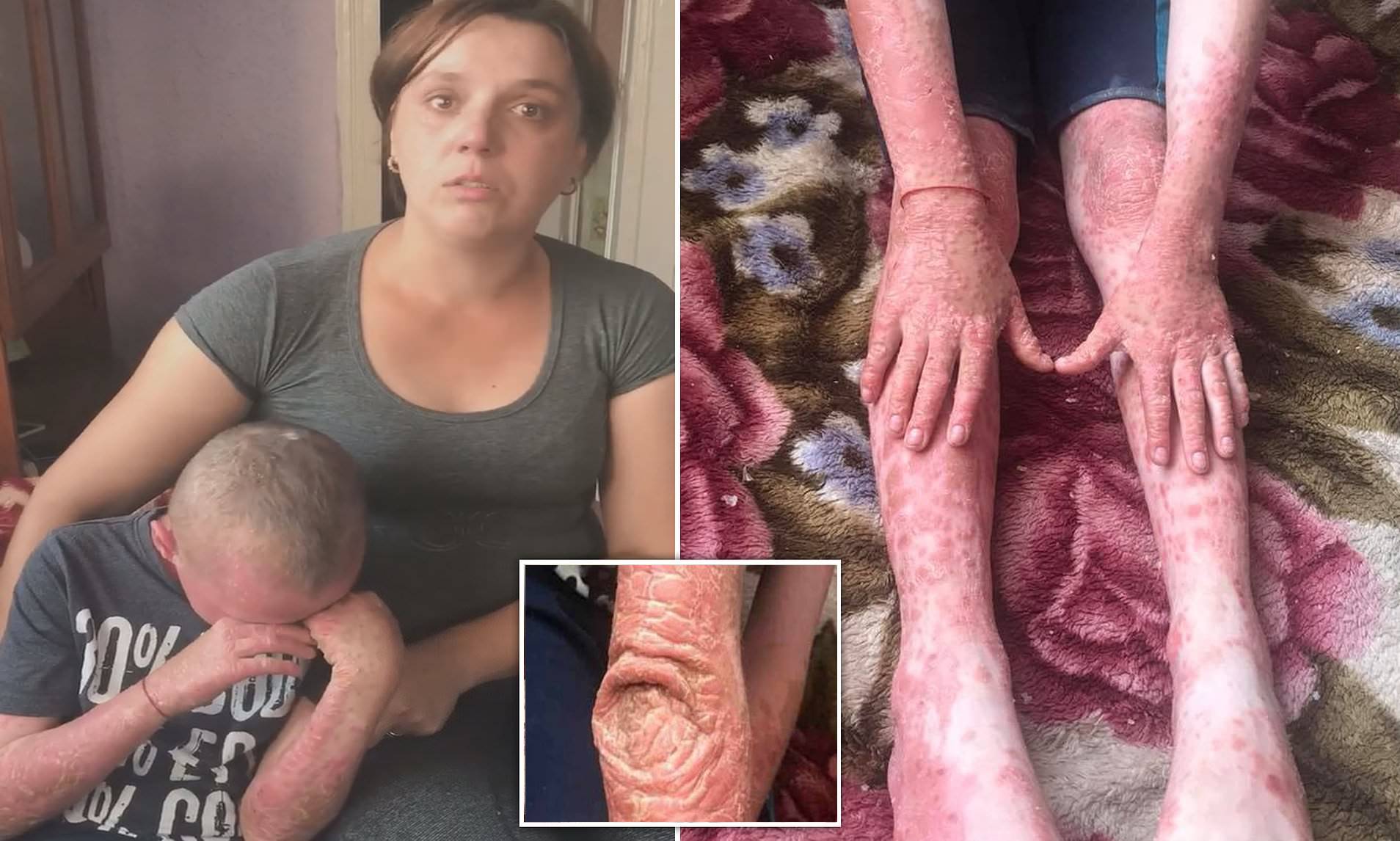 Resultado de imagem para Menino diz a mãe 'eu quero morrer' após médico desistir de tratá-lo