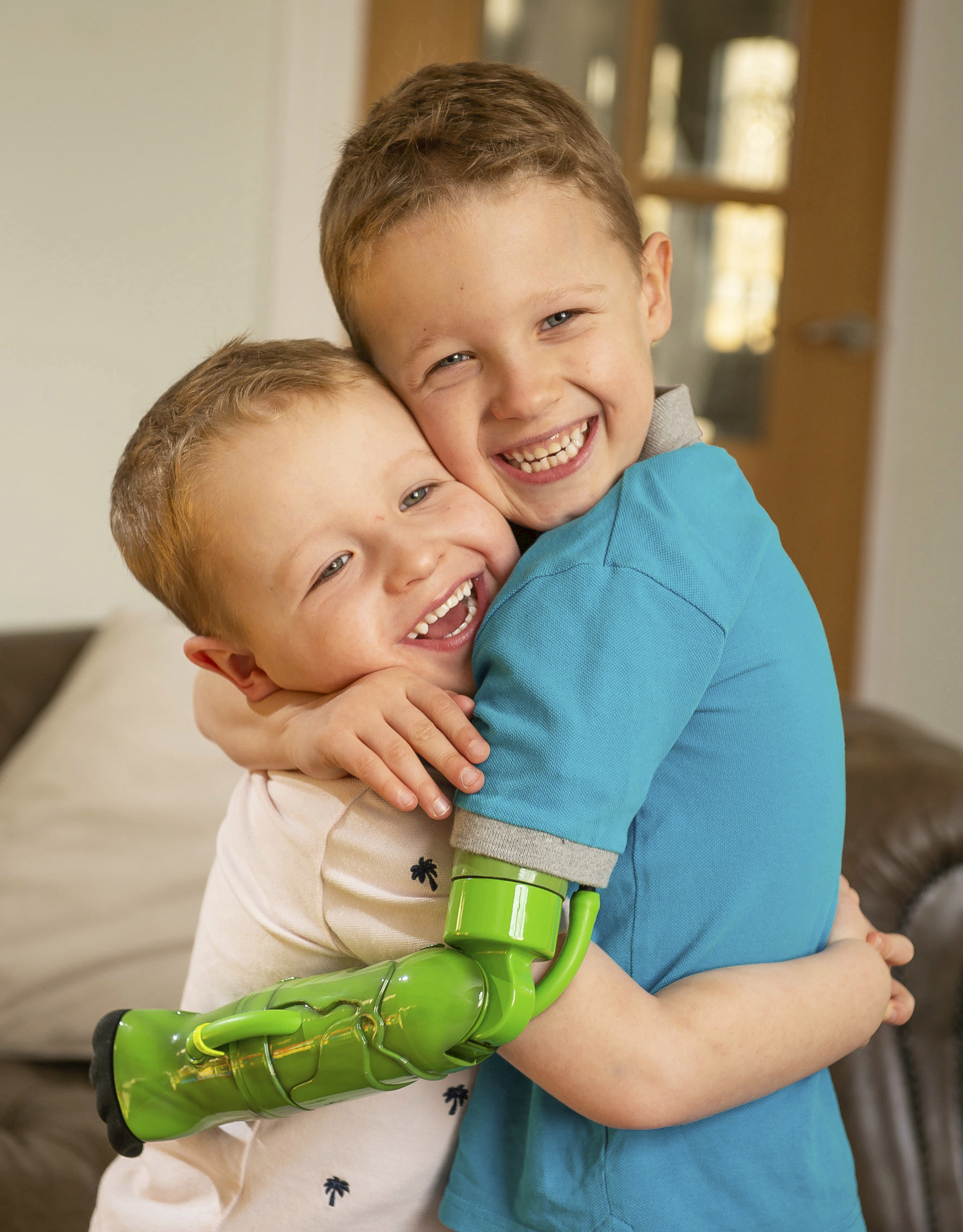 Duas crianças  meninos loiros, abraçados, um dos meninos usa uma protese do hulk em seu braço